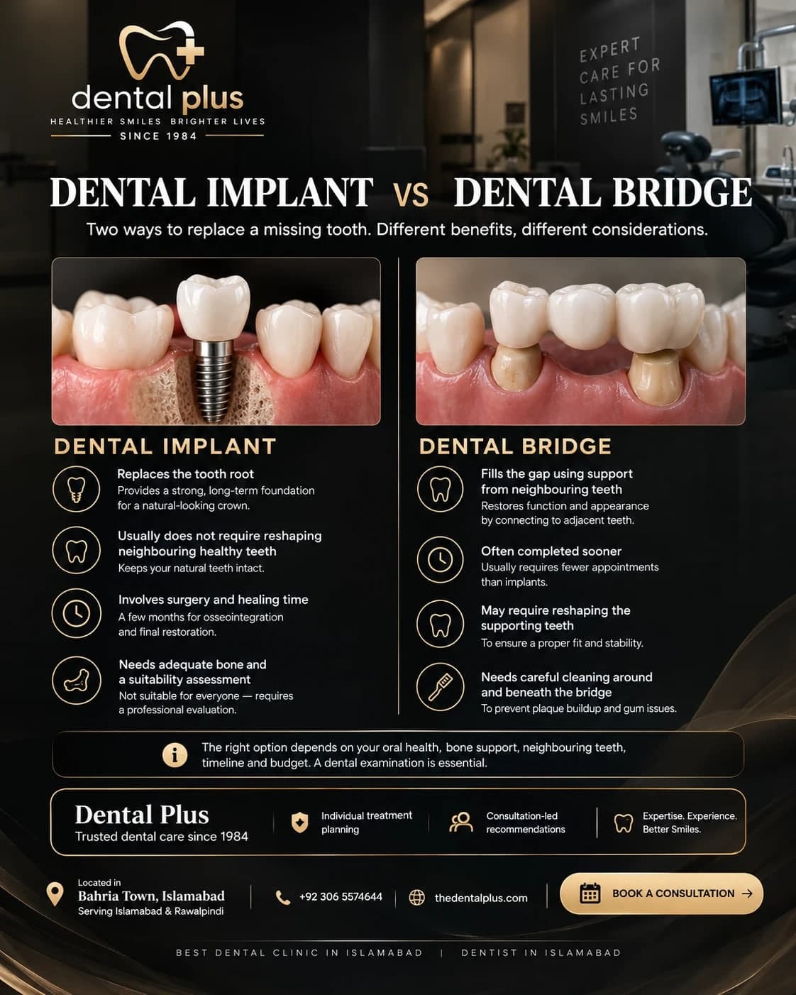Dental implant vs dental bridge infographic: an implant replaces the tooth root and needs enough bone and months of healing; a bridge is supported by the reshaped neighbouring teeth and needs careful cleaning underneath
